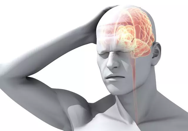 How to Manage Mesalamine-Induced Headaches and Migraines